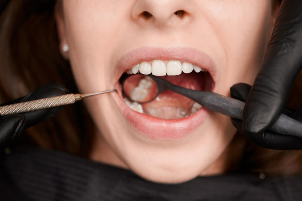 Dental Care in Mt Vernon, NY