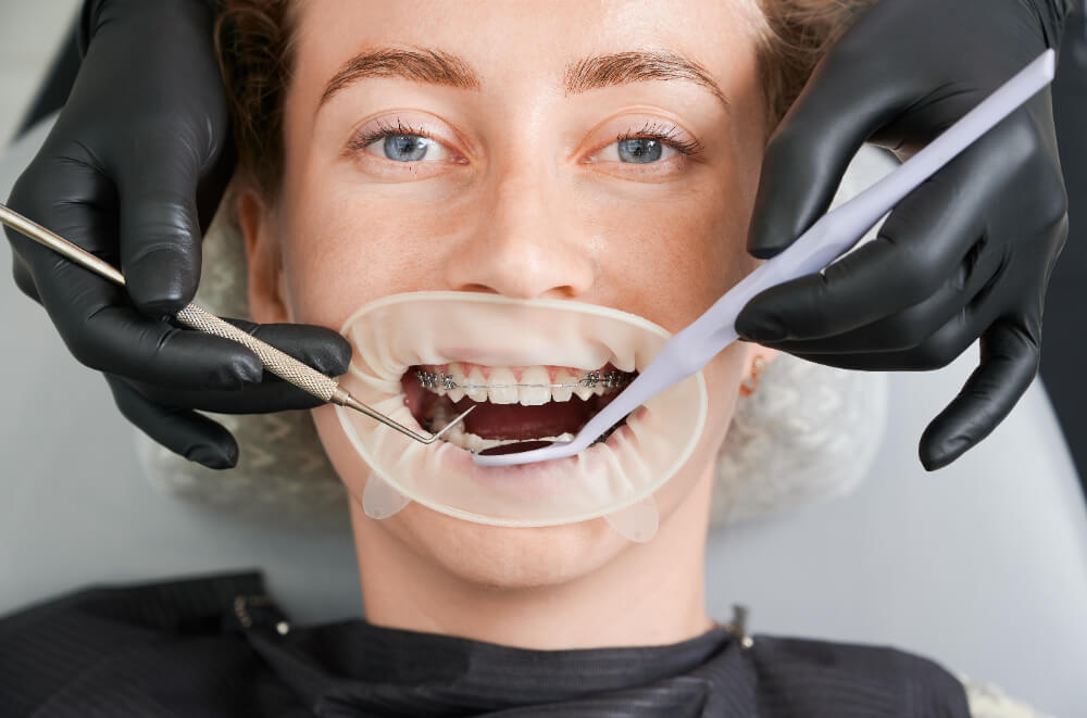 Restorative Dentistry in Mt. Vernon, NY