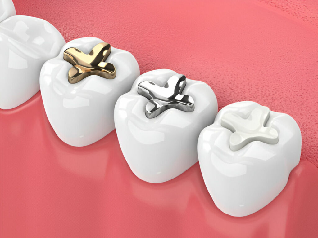 Dental Sealants in Mount Vernon, NY