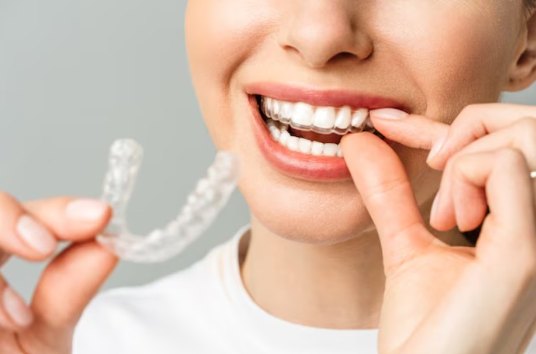 Invisalign in mount Vernon NY