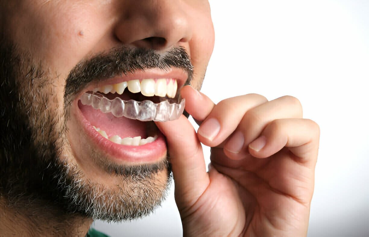 Invisalign in Mt. Vernon, NY