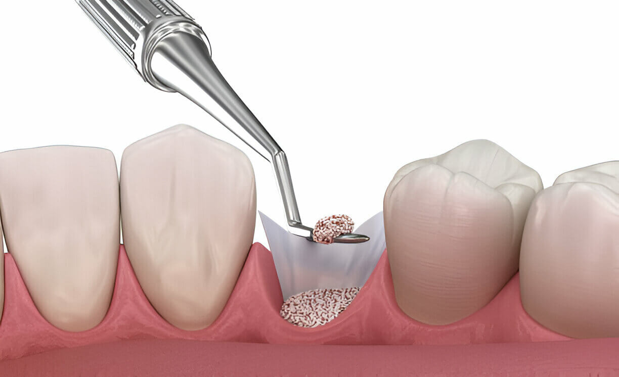 Restorative Dentistry Mt Vernon NY