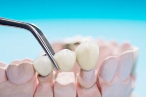 Restorative dentistry in Mt. Vernon, NY1