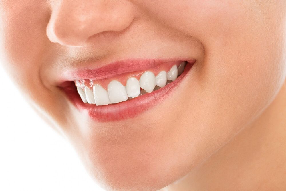 Teeth Whitening Treatment in Mt Vernon NY